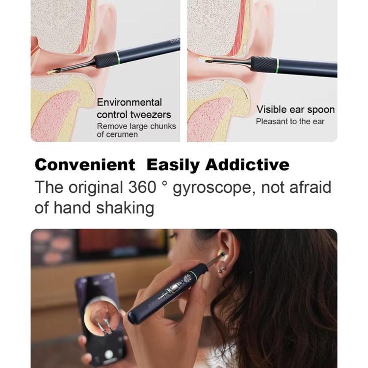 Bebird Note5 Pro Visual Ear Scoop Ear Picking Tool Cleaning Set